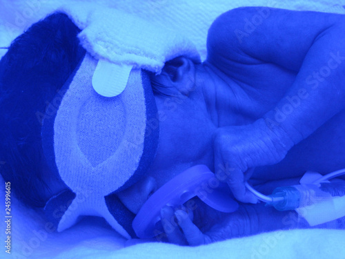 Premature baby with blue bilirubin lights photo