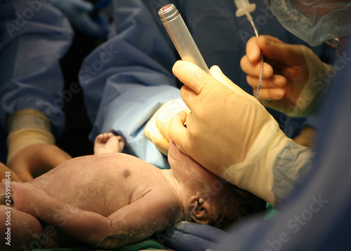 Newborn intubation in delivery room photo