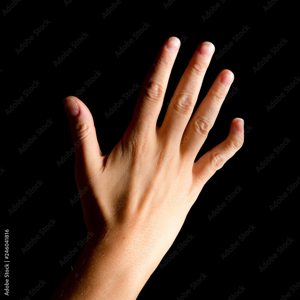 Woman hand with the pinky little finger due to arthritis Woman hand with the pinky little finger due to arthritis