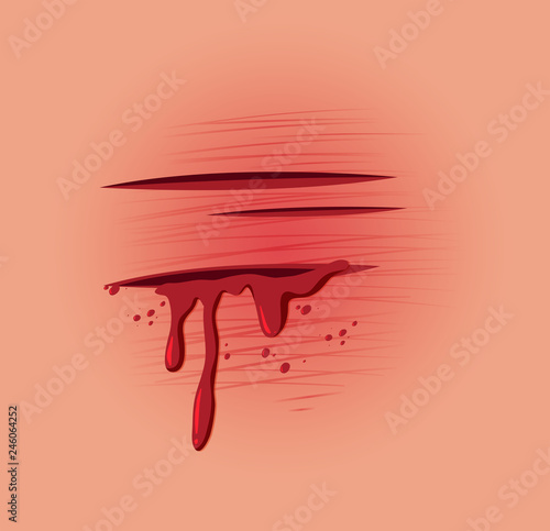 A skin fresh wound