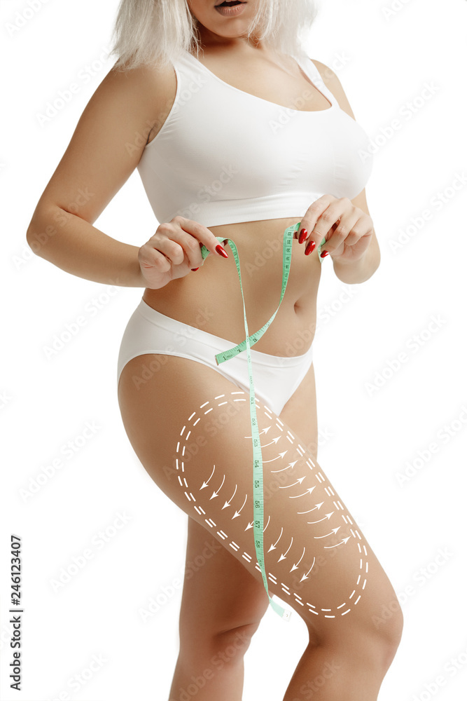 Female body with the drawing arrows. Fat lose, liposuction and cellulite removal concept. Marks on the woman before plastic surgery. Image is not body shape retouched