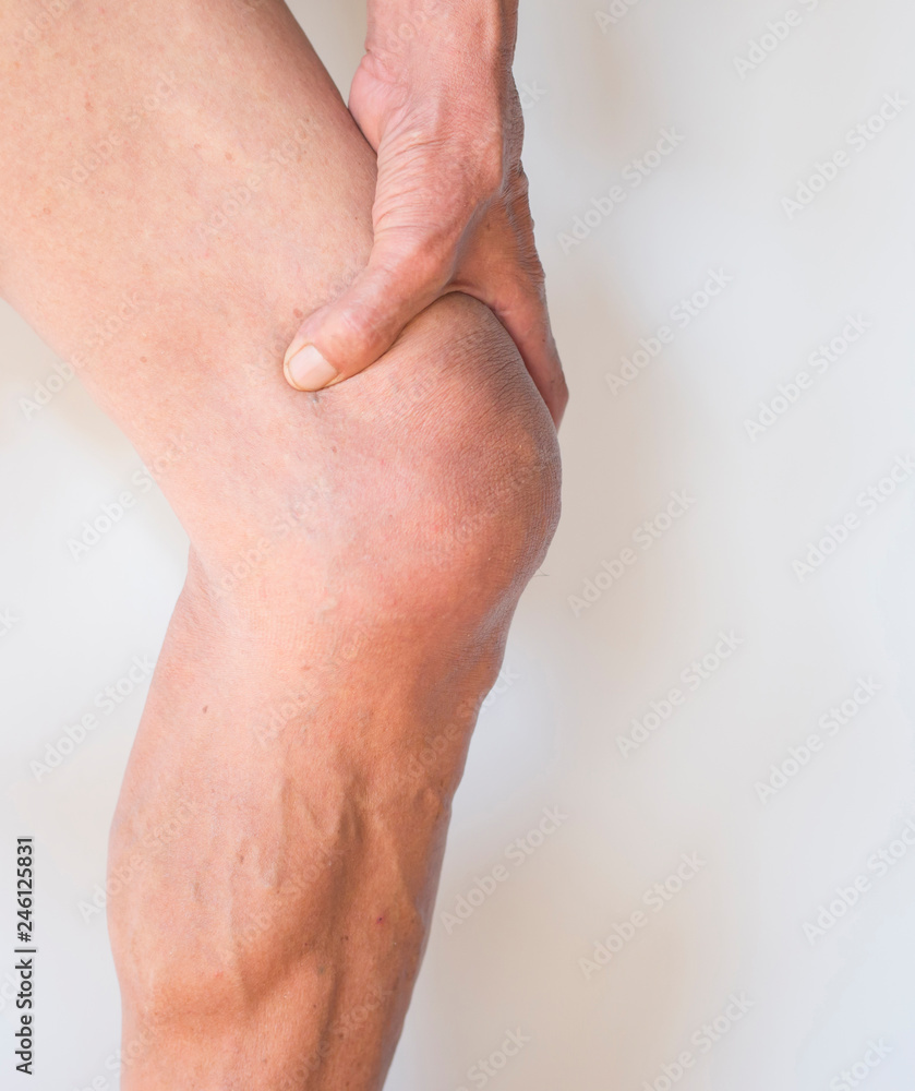 Fototapeta premium Leg muscles at the knees of older men with inflammation and pain