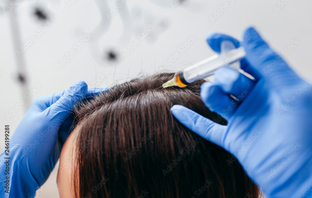 Young woman with hair loss problem receiving injection, close up Young woman with hair loss problem receiving injection, close up