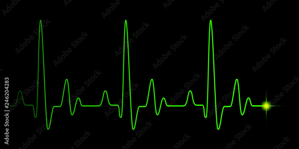 Heart pulse green graphic line on black