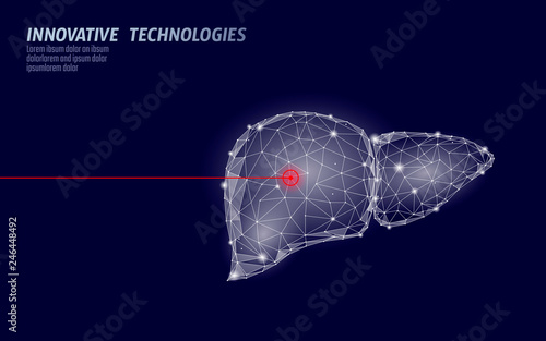 Human liver laser surgery operation low poly. Medicine disease drug treatment painful area. Red triangles polygonal 3D render shape. Pharmacy hepatitis cancer template vector illustration