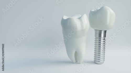 Fototapeta Naklejka Na Ścianę i Meble -  Tooth human implant - 3D Rendering