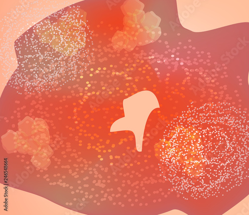 Erythrodermic psoriasis texture. Eczema, dermatitis skin disease psoriasis. Infographics. Vector illustration.