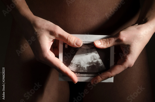 Ultrasonic photo in the hands of a naked girl.