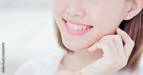 woman with retainer for teeth photo