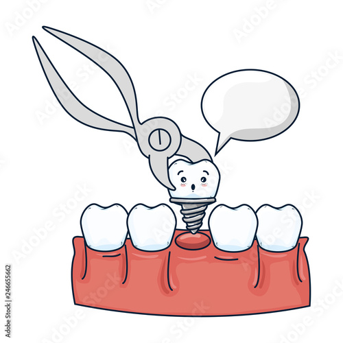 human teeth with pliers extracting implant
