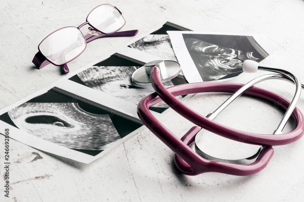Phonendoscope vs stethoscope and glasses lie on ultrasound images of