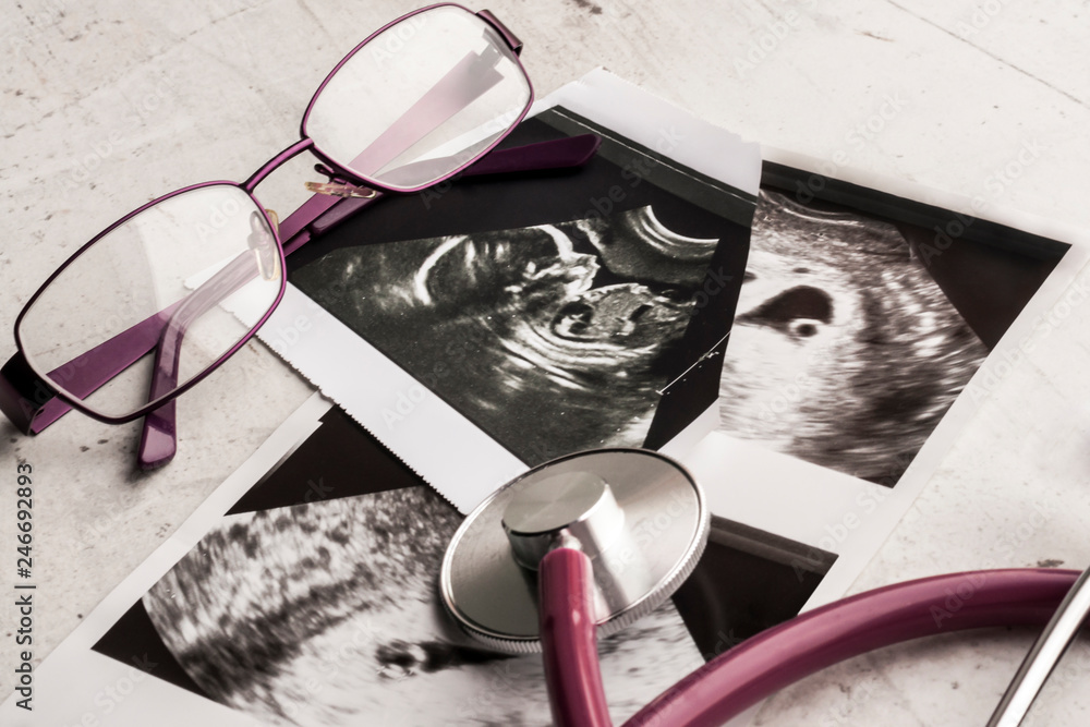 Phonendoscope vs stethoscope and glasses lie on ultrasound images of