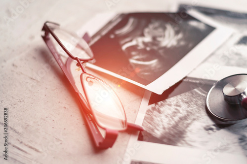 Phonendoscope vs stethoscope and glasses lie on ultrasound images of the embryo at 4 and 20 weeks of gestation. IVF in vitro fertilization concept. Observation. Selective focus.