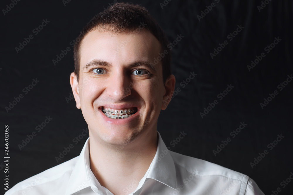 Portrait of a man of Caucasian appearance in orthodontic braces, metal brackets on his teeth in a white shirt on a black background. Dental concept, medicinal alignment of teeth orthodontist. Portrait of a man of Caucasian appearance in orthodontic braces, metal brackets on his teeth in a white shirt on a black background. Dental concept, medicinal alignment of teeth orthodontist.