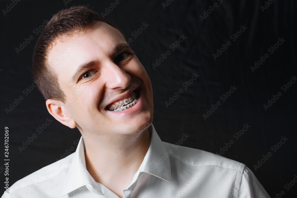 Portrait of a man of Caucasian appearance in orthodontic braces, metal brackets on his teeth in a white shirt on a black background. Dental concept, medicinal alignment of teeth orthodontist. Portrait of a man of Caucasian appearance in orthodontic braces, metal brackets on his teeth in a white shirt on a black background. Dental concept, medicinal alignment of teeth orthodontist.