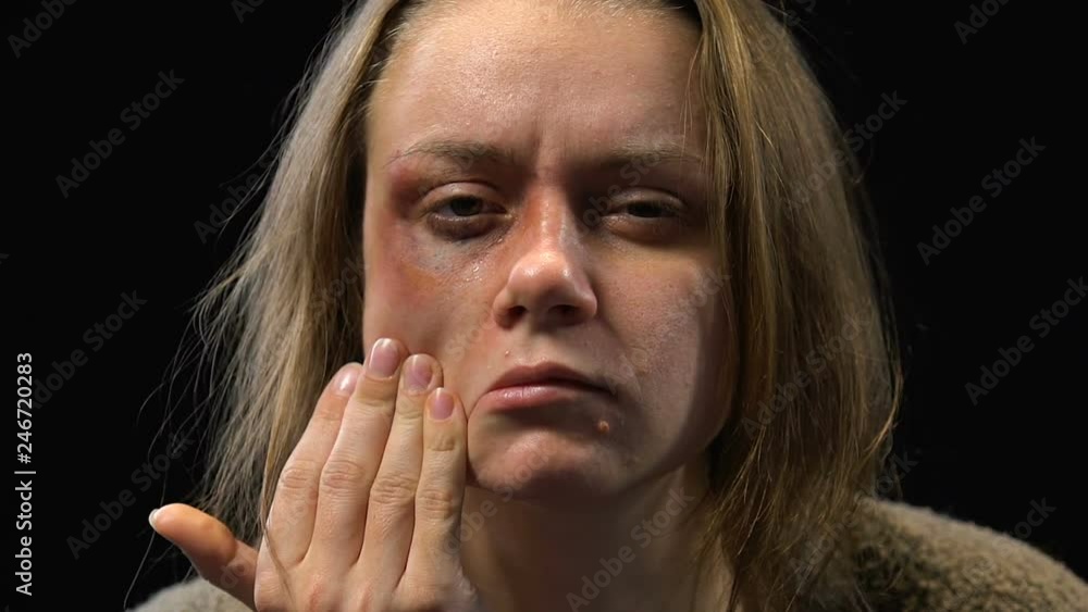 Determined bruised woman wiping tears away, ready to protect herself, no abuse Determined bruised woman wiping tears away, ready to protect herself, no abuse