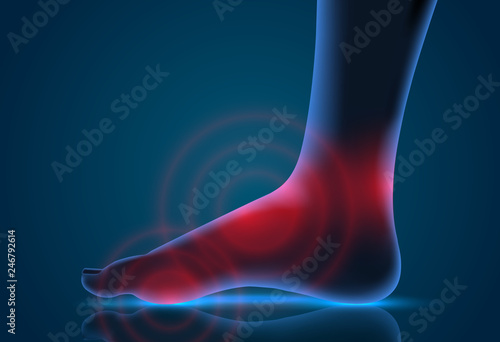 vector human foot. blue contour and red spots of pain. ready element for medicine and orthopedics