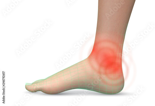vector human foot.red spots of pain. ready element for medicine and orthopedics