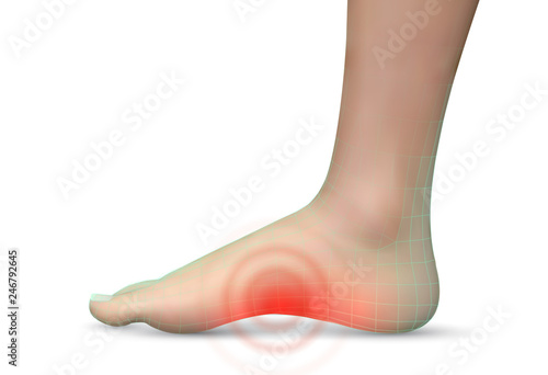 vector human foot.red spots of pain. ready element for medicine and orthopedics