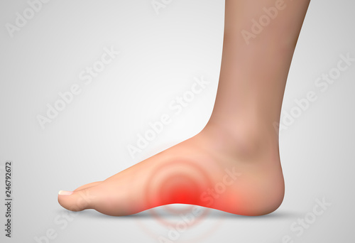 vector human foot.red spots of pain. ready element for medicine and orthopedics