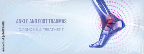 Horizontal ankle and foot traumas banner for social media