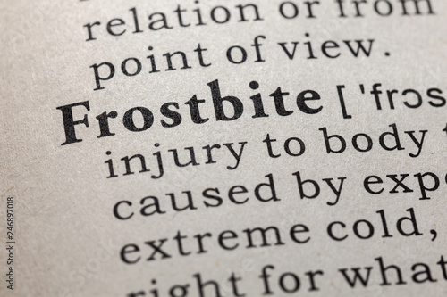 Foto definition of frostbite