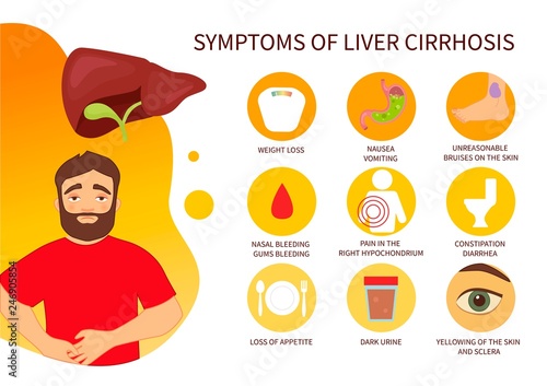 Vector poster of liver cirrhosis symptoms. Illustration of a cartoon man. photo