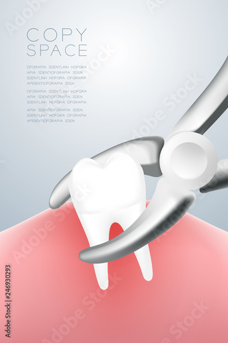 Dental handpieces pliers instrument extraction tooth pulling out from gum, illustration 3D virtual design isolated on grey gradients background, with copy space, vector eps 10