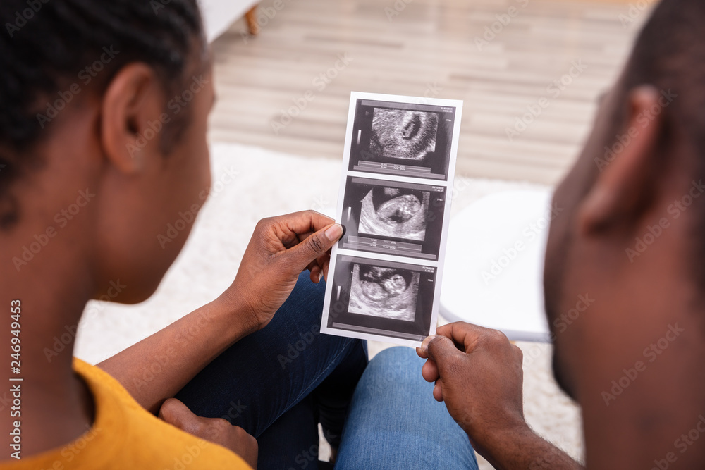 Couple Looking At Ultrasound Scan Report Couple Looking At Ultrasound Scan Report
