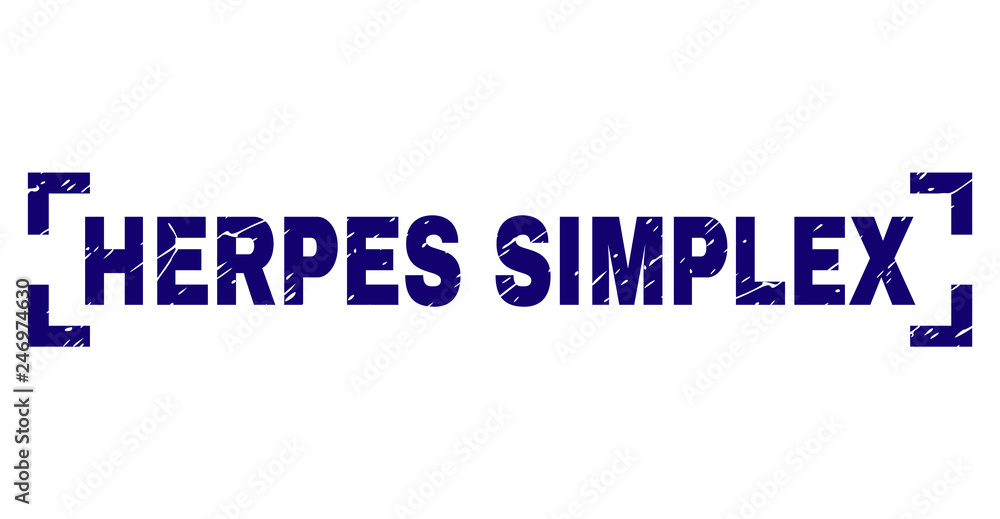 HERPES SIMPLEX text seal imprint with distress texture. Text title is placed inside corners. Blue vector rubber print of HERPES SIMPLEX with unclean texture.