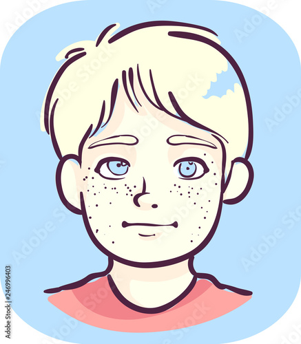 Kid Boy Pale Skin Cross Eye Light Color Hair