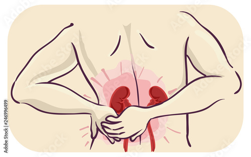 Man Kidney Malfunction Illu...