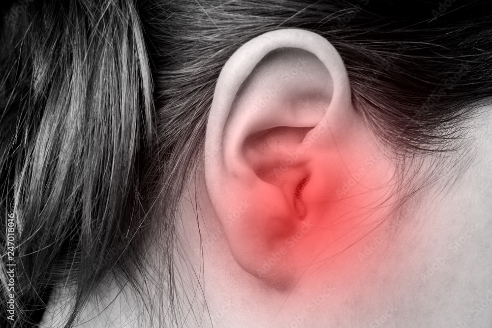 Close up of female ear with source of pain. Earache. Close up of female ear with source of pain. Earache.