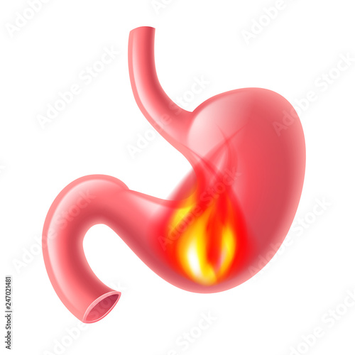 Stomach heartburn isolated on white vector illustration