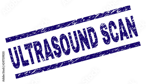 ULTRASOUND SCAN seal print with distress style. Blue vector rubber print of ULTRASOUND SCAN text with scratched texture. Text label is placed between parallel lines.