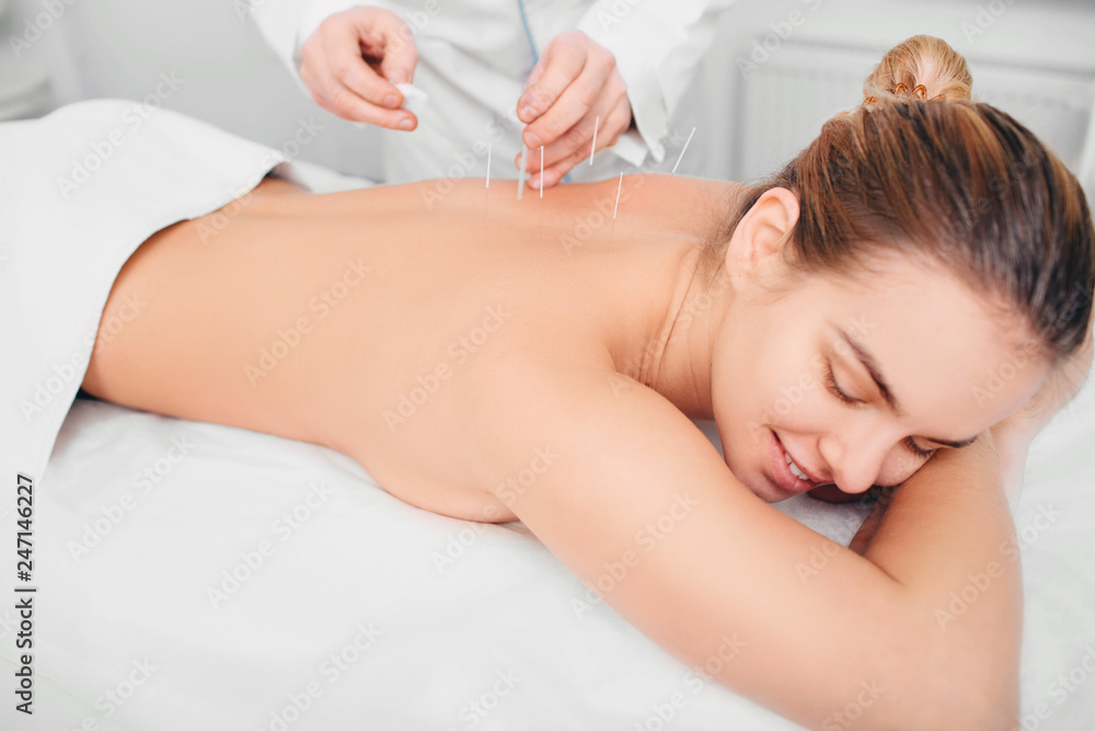 Acupuncturist inserting a needle into a female back. patient having traditional Chinese treatment using needles to restore an energy flow through specific points on the skin. Acupuncturist inserting a needle into a female back. patient having traditional Chinese treatment using needles to restore an energy flow through specific points on the skin.