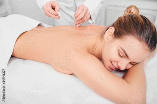 Acupuncturist inserting a needle into a female back. patient having traditional Chinese treatment using needles to restore an energy flow through specific points on the skin.