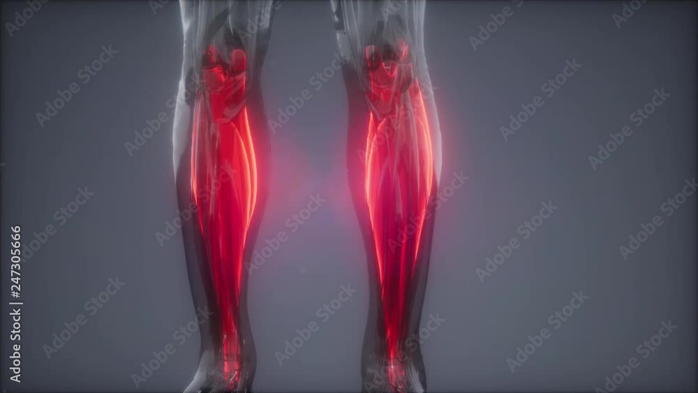 gastrocnemius- Visible muscle anatomy map gastrocnemius- Visible muscle anatomy map