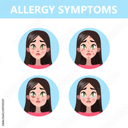Allergy symptoms infographic. Runny nose and eye redness