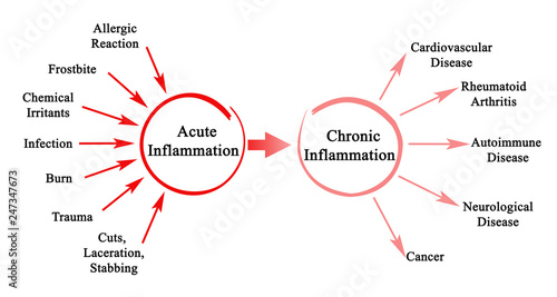 Acute and Chronic  Inflammation
