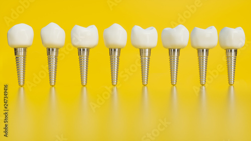 Fototapeta Naklejka Na Ścianę i Meble -  Tooth human implant. Human teeth or dentures on yellow background - 3d rendering