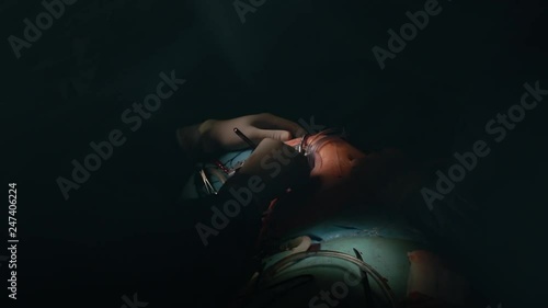 Closeup of minithoracotomy surgery with surgeon in surgery center for interventions with instruments in surgeon operation electrosurgery with microsurgery doing minimal invasive open heart surgery photo