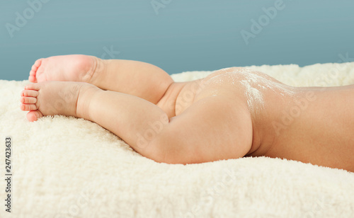 Naked butt of a baby with powdered irritation and prysy at the doctor’s appointment on an isolated blue background. Concept of child