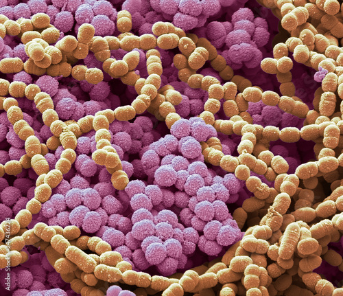 Sputum culture, SEM