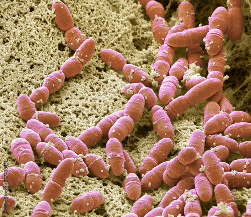 Streptococcus mutans, SEM photo