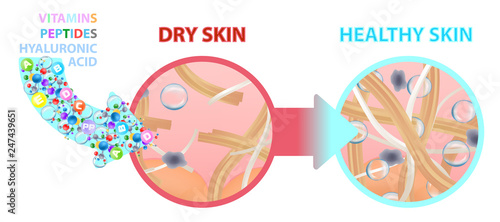 Dry skin enriched with vitamins, nutrition. Healthy skin. Vector illustration