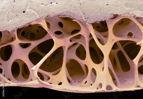 Bird bone tissue, SEM