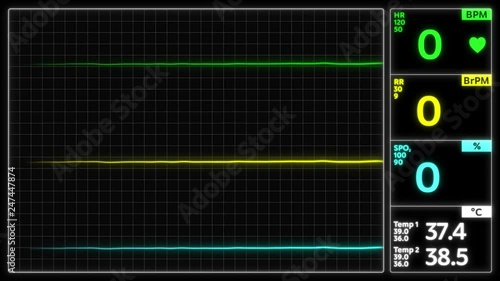 Stylized EKG Flatline, Green. Close up on pixelated heart rate monitor screen / electrocardiogram (EKG or ECG) beeping then flatlines. Shallow depth of field 4k