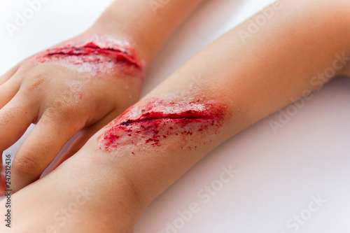 Fake wounds on the arms of children dress the wound special effect