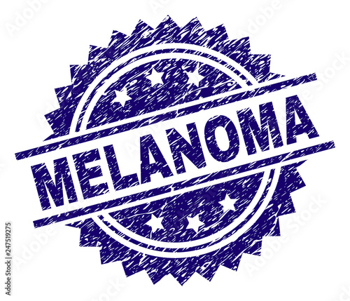 MELANOMA stamp seal watermark with distress style. Blue vector rubber print of MELANOMA tag with dust texture.